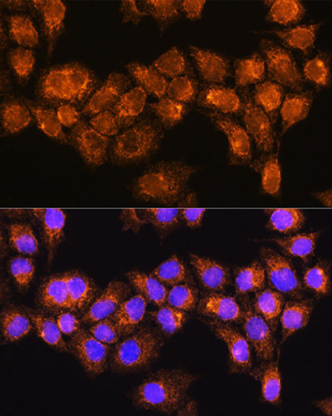 Cell Biology Antibodies 3 Anti-RABL3 Antibody CAB14327