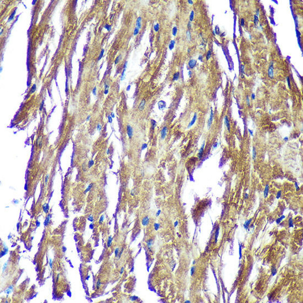 Cell Biology Antibodies 4 Anti-NDUFAF4 Antibody CAB14345