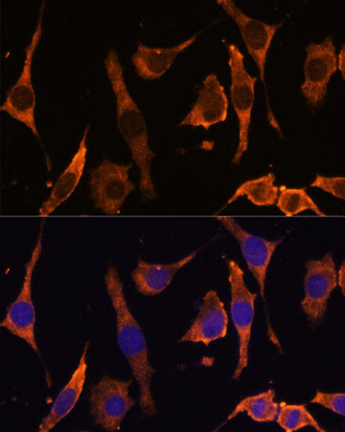 Epigenetics and Nuclear Signaling Antibodies 3 Anti-RPL36AL Antibody CAB14366