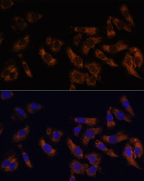 Epigenetics and Nuclear Signaling Antibodies 3 Anti-RPL36AL Antibody CAB14366
