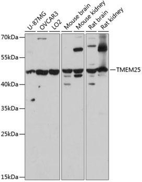 Cell Biology Antibodies 4 Anti-TMEM25 Antibody CAB14370