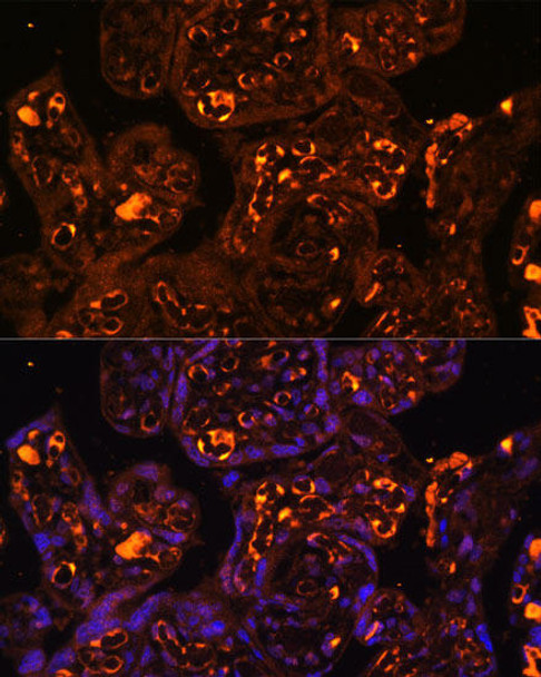 Immunology Antibodies 1 Anti-LAIR2 Antibody CAB14376