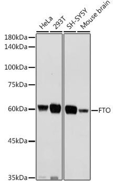 Epigenetics and Nuclear Signaling Antibodies 3 Anti-FTO Antibody CAB1438