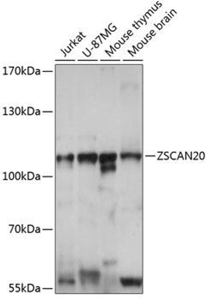 Epigenetics and Nuclear Signaling Antibodies 3 Anti-ZSCAN20 Antibody CAB14383