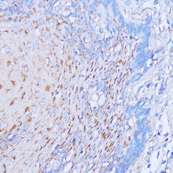 Cell Death Antibodies 1 Anti-NME6 Antibody CAB14388