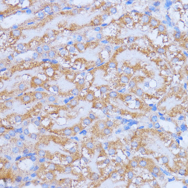 Cell Death Antibodies 1 Anti-NME6 Antibody CAB14388