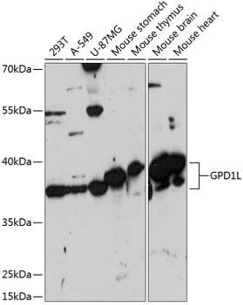 Cell Biology Antibodies 5 Anti-GPD1L Antibody CAB14392