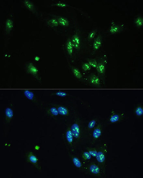 Epigenetics and Nuclear Signaling Antibodies 3 Anti-CCDC59 Antibody CAB14399