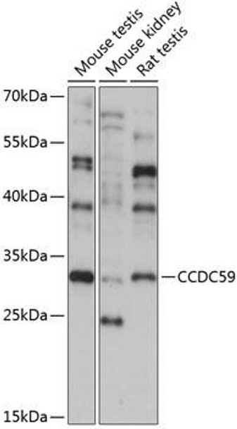 Epigenetics and Nuclear Signaling Antibodies 3 Anti-CCDC59 Antibody CAB14399