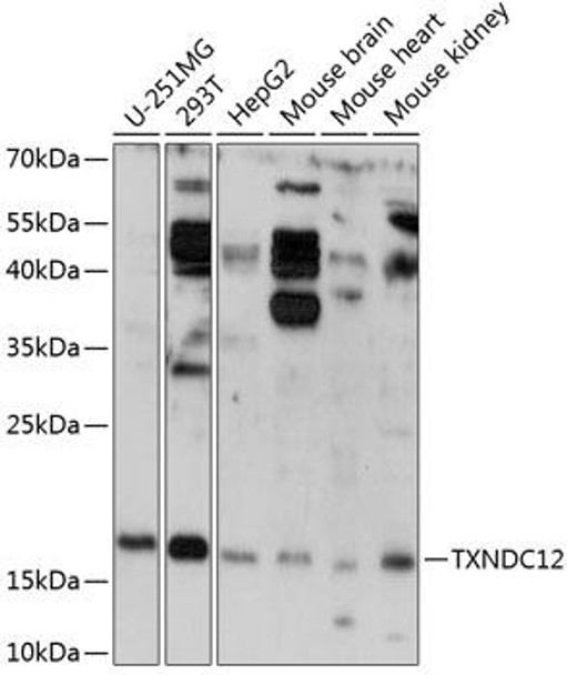 Signal Transduction Antibodies 1 Anti-TXNDC12 Antibody CAB14403