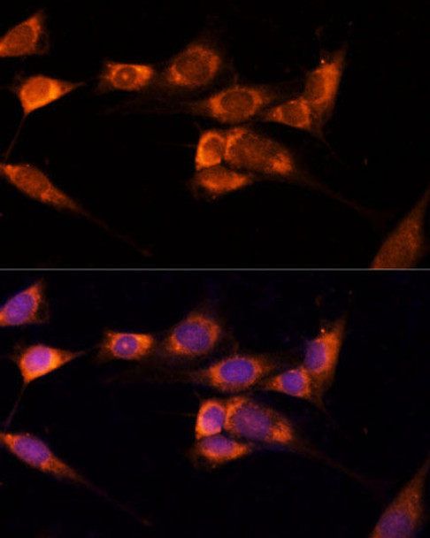Signal Transduction Antibodies 1 Anti-TXNDC12 Antibody CAB14403