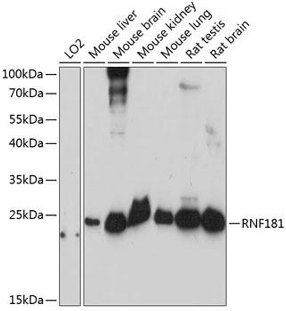 Cell Biology Antibodies 5 Anti-RNF181 Antibody CAB14405