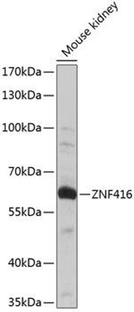 Epigenetics and Nuclear Signaling Antibodies 3 Anti-ZNF416 Antibody CAB14411