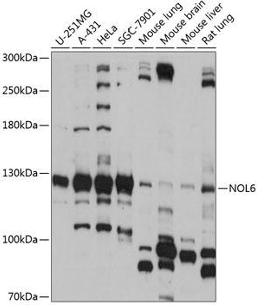 Epigenetics and Nuclear Signaling Antibodies 3 Anti-NOL6 Antibody CAB14420