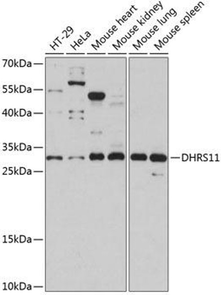 Metabolism Antibodies 1 Anti-DHRS11 Antibody CAB14422