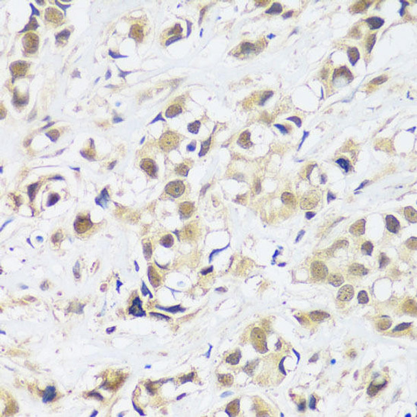 Epigenetics and Nuclear Signaling Antibodies 3 Anti-ASCL4 Antibody CAB14439