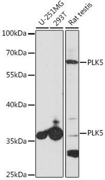 Cell Cycle Antibodies 1 Anti-PLK5 Antibody CAB14442