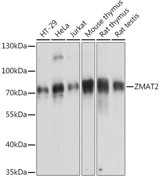 Epigenetics and Nuclear Signaling Antibodies 3 Anti-ZMAT2 Antibody CAB14456