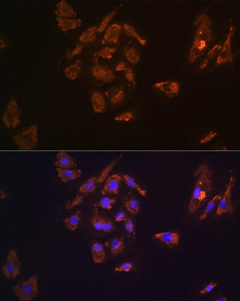 Cell Biology Antibodies 5 Anti-TRH Antibody CAB14472