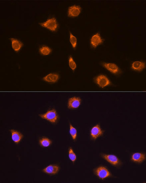 Cell Biology Antibodies 5 Anti-TRH Antibody CAB14472