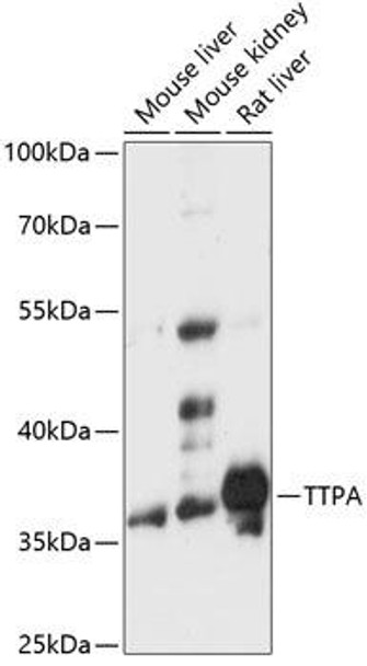 Signal Transduction Antibodies 1 Anti-TTPA Antibody CAB14473