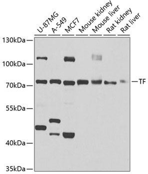 Signal Transduction Antibodies 1 Anti-TF Antibody CAB1448
