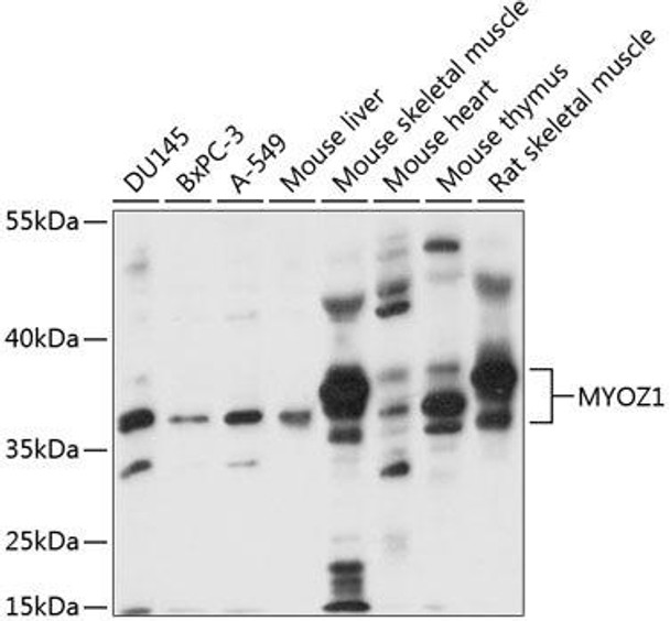 Cell Biology Antibodies 5 Anti-MYOZ1 Antibody CAB14483