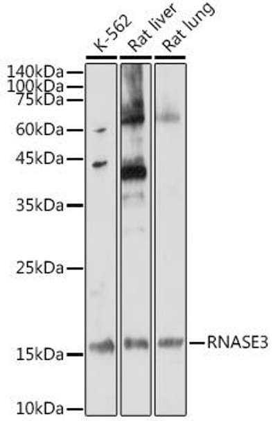 Cell Biology Antibodies 5 Anti-RNASE3 Antibody CAB14489