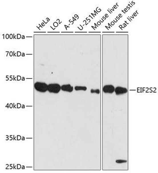 Metabolism Antibodies 1 Anti-EIF2S2 Antibody CAB14498