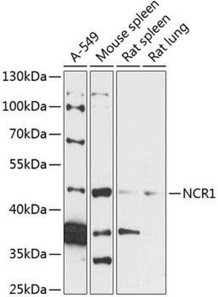 Cell Biology Antibodies 5 Anti-NCR1 Antibody CAB14499