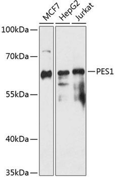 Cell Biology Antibodies 5 Anti-PES1 Antibody CAB14506