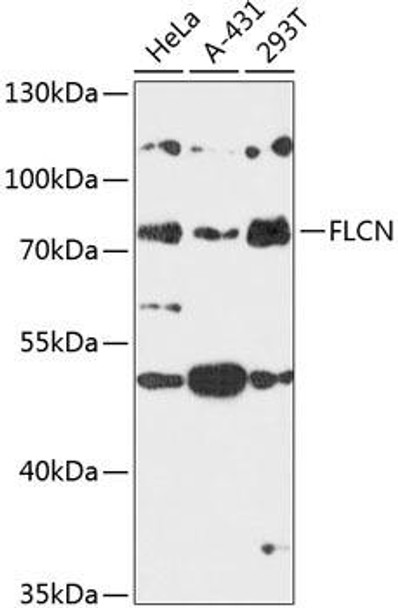 Cell Biology Antibodies 5 Anti-FLCN Antibody CAB14521