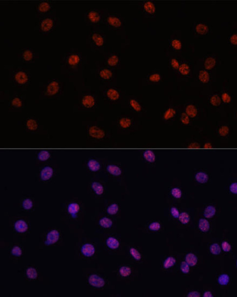 Cell Biology Antibodies 5 Anti-MYCT1 Antibody CAB14541