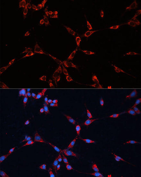 Cell Cycle Antibodies 1 Anti-GNAI2 Antibody CAB14547