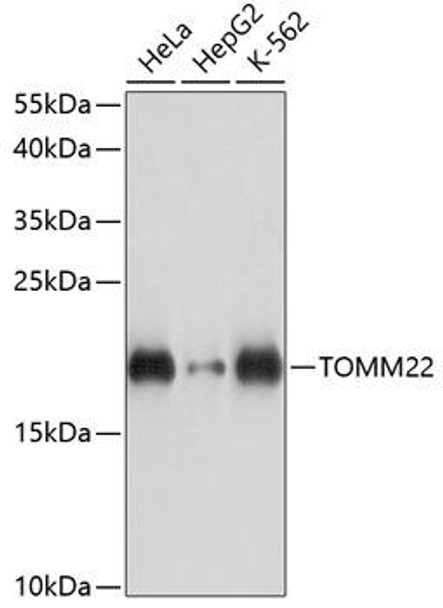 Cell Biology Antibodies 5 Anti-TOMM22 Antibody CAB14548