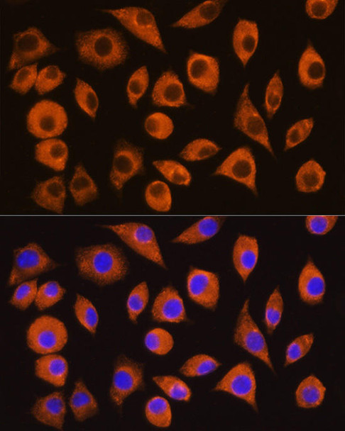 Cell Biology Antibodies 5 Anti-DPP4 Antibody CAB1455