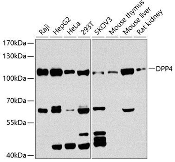 Cell Biology Antibodies 5 Anti-DPP4 Antibody CAB1455