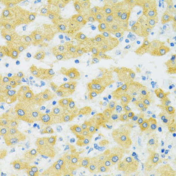 Signal Transduction Antibodies 1 Anti-SLC37A4 Antibody CAB14564