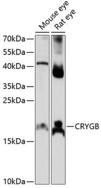 Cell Biology Antibodies 5 Anti-CRYGB Antibody CAB14569