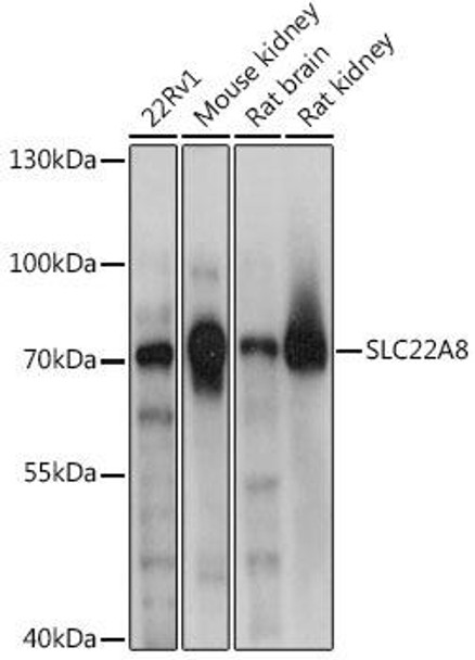Cell Biology Antibodies 5 Anti-SLC22A8 Antibody CAB14575