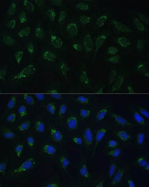 Cell Biology Antibodies 5 Anti-HIGD1A Antibody CAB14582