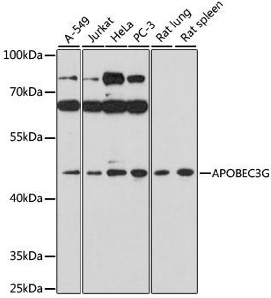 Immunology Antibodies 1 Anti-APOBEC3G Antibody CAB1459