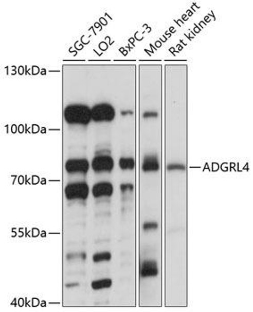 Signal Transduction Antibodies 1 Anti-ADGRL4 Antibody CAB14595