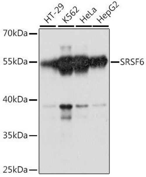Epigenetics and Nuclear Signaling Antibodies 3 Anti-SRSF6 Antibody CAB14603