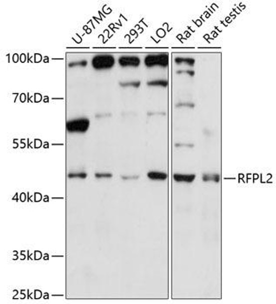 Cell Biology Antibodies 5 Anti-RFPL2 Antibody CAB14604