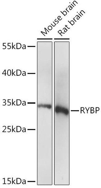 Cell Death Antibodies 1 Anti-RYBP Antibody CAB14605