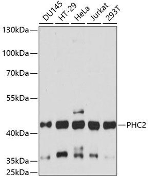 Cell Biology Antibodies 5 Anti-PHC2 Antibody CAB14610
