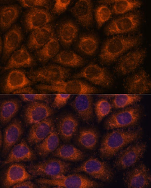 Signal Transduction Antibodies 1 Anti-CCT6B Antibody CAB14615