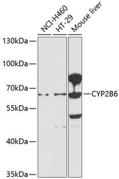 Cell Biology Antibodies 5 Anti-CYP2B6 Antibody CAB1463