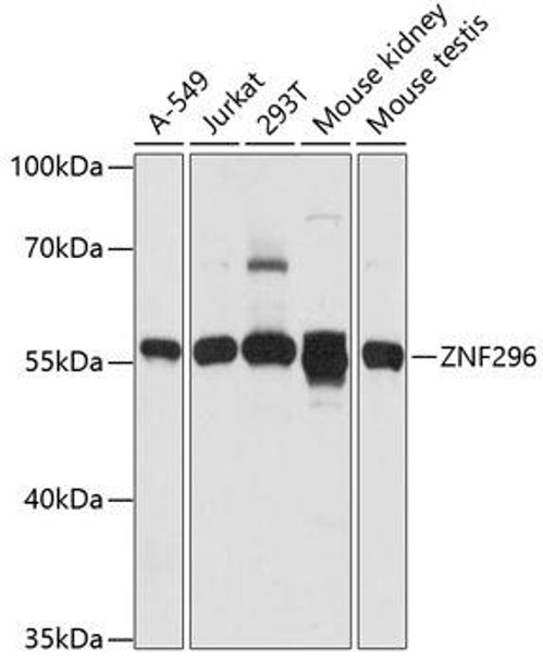Epigenetics and Nuclear Signaling Antibodies 3 Anti-ZNF296 Antibody CAB14633